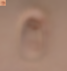 NavelZoom.png
