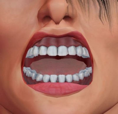 Star_teeth_tri_illustr.JPG