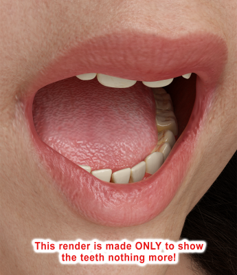 07_Jennifer_teeth.png