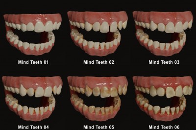 Teeth.jpg