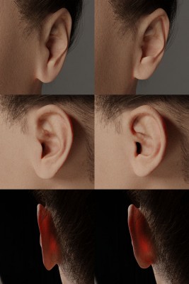 Ear_details_on_Jennifer_before_after.jpg